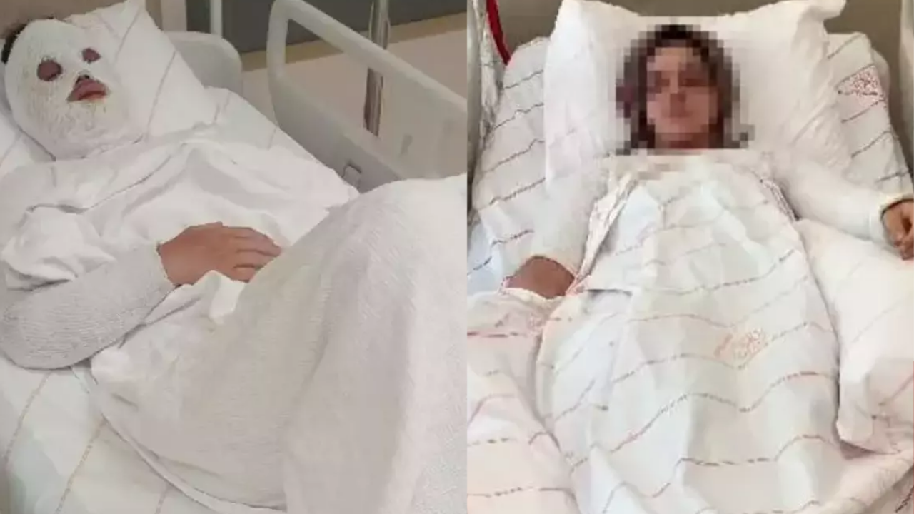 Eski Nişanlısına Kimyasal Attı: Verilen Ceza İsyan Ettirdi