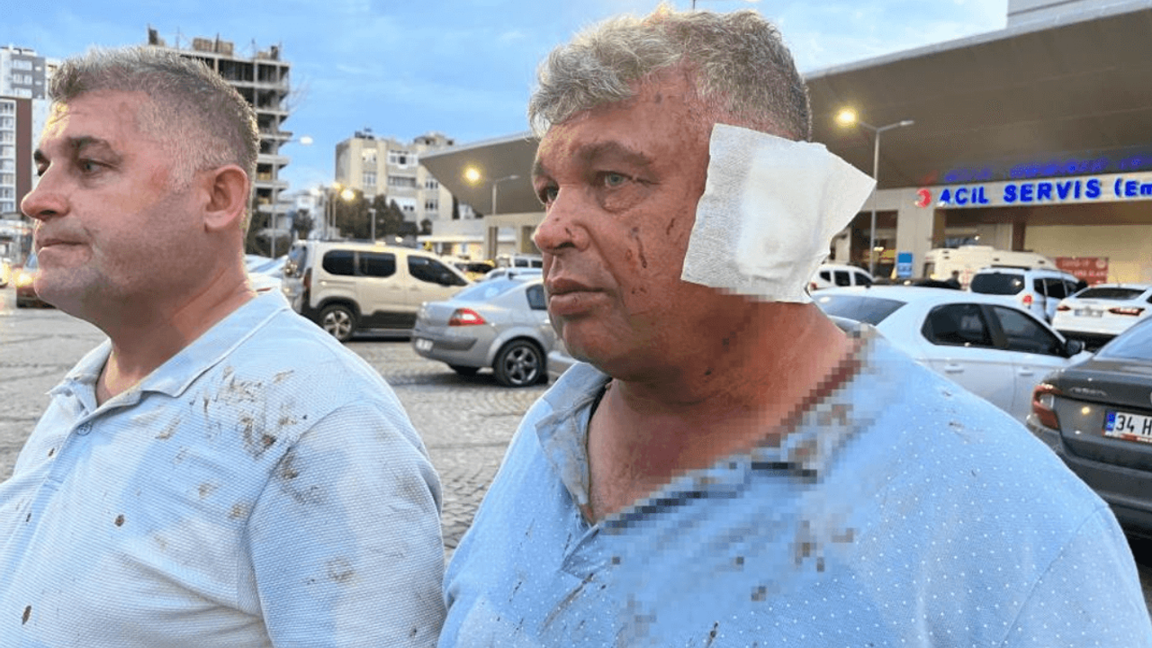 Dolmuş Sürücüsüyle Tartışan Abi Ve Kardeşi Feci Şekilde Darp Edildi!