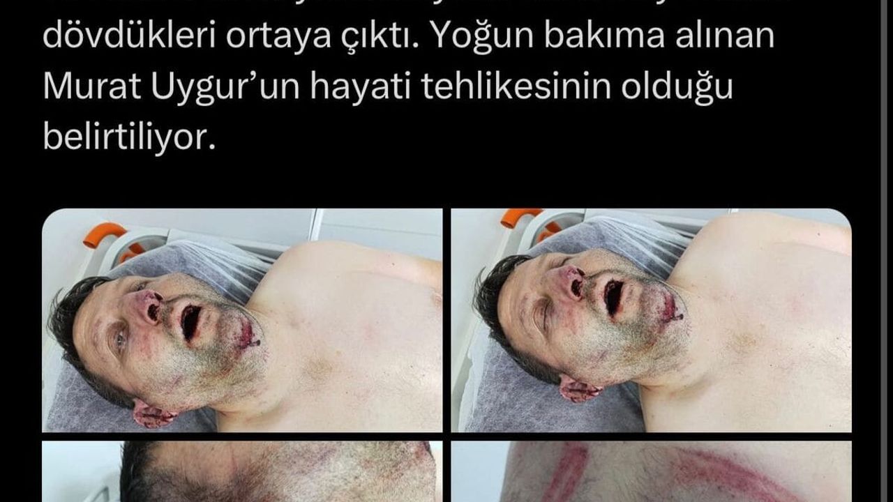 Baki Ersoy, Özgür Özel'e ''Azmettiricisi Siz Mi Oluyorsunuz''