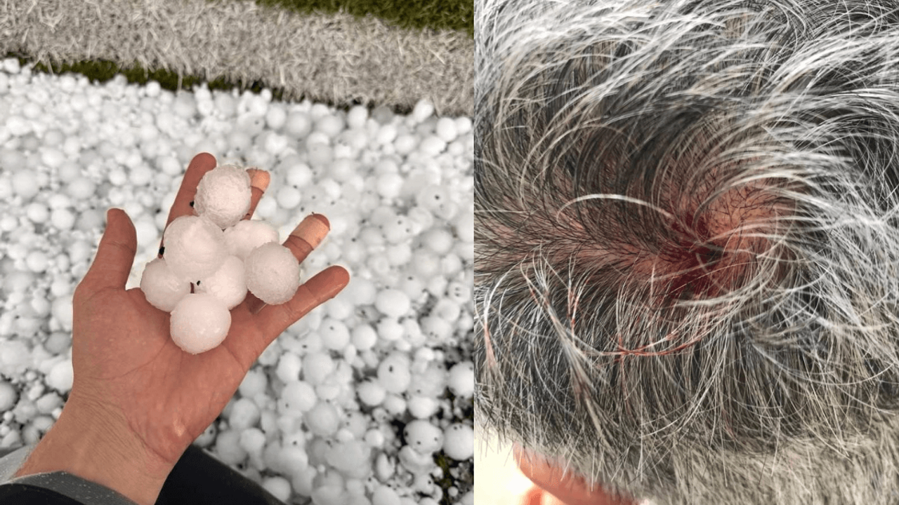 Kayseri’de Ceviz Büyüklüğündeki Dolu Vatandaşın Kafasını Yardı!