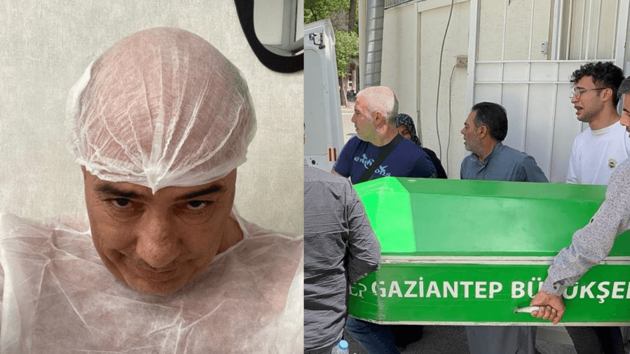 Saç Ektirme İşlemi Sonu Oldu: Gittiği Hastaneden Cenazesi Çıktı!