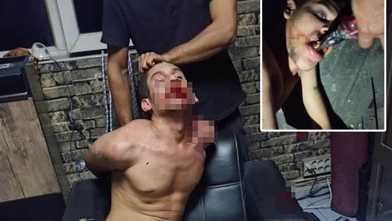 Böyle İşkence Görülmedi! Böcek Yedirdiler, Kerpetenle Dişlerini Söktüler