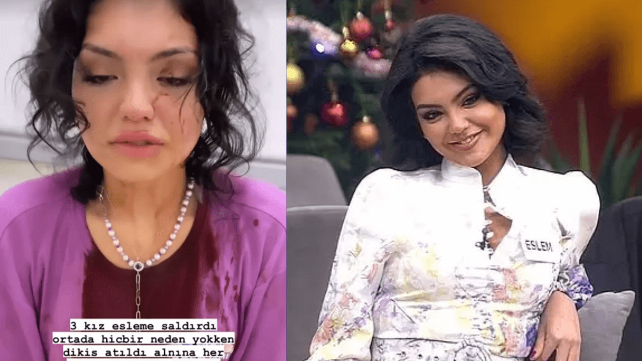 Kısmetse olur Yarışmacısı Saldırıya Uğradı! Kan Revan İçinde Kaldı!