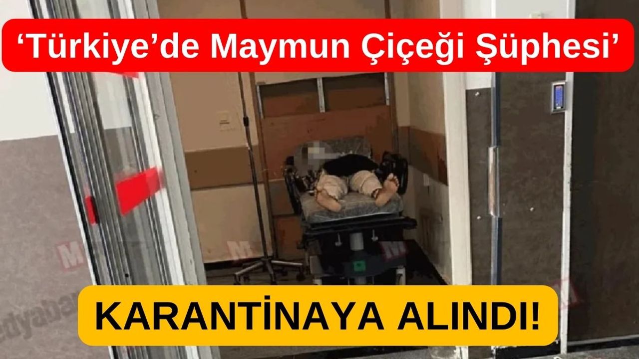 Türkiye'de Maymun Çiçeği Şüphesiyle Karantinaya alındı!