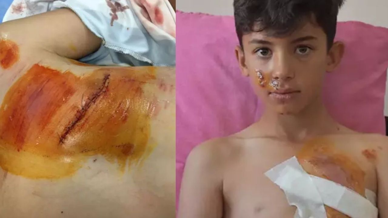 Göğüsüne İnşaat Demiri Saplandı! Ölümden Döndü!
