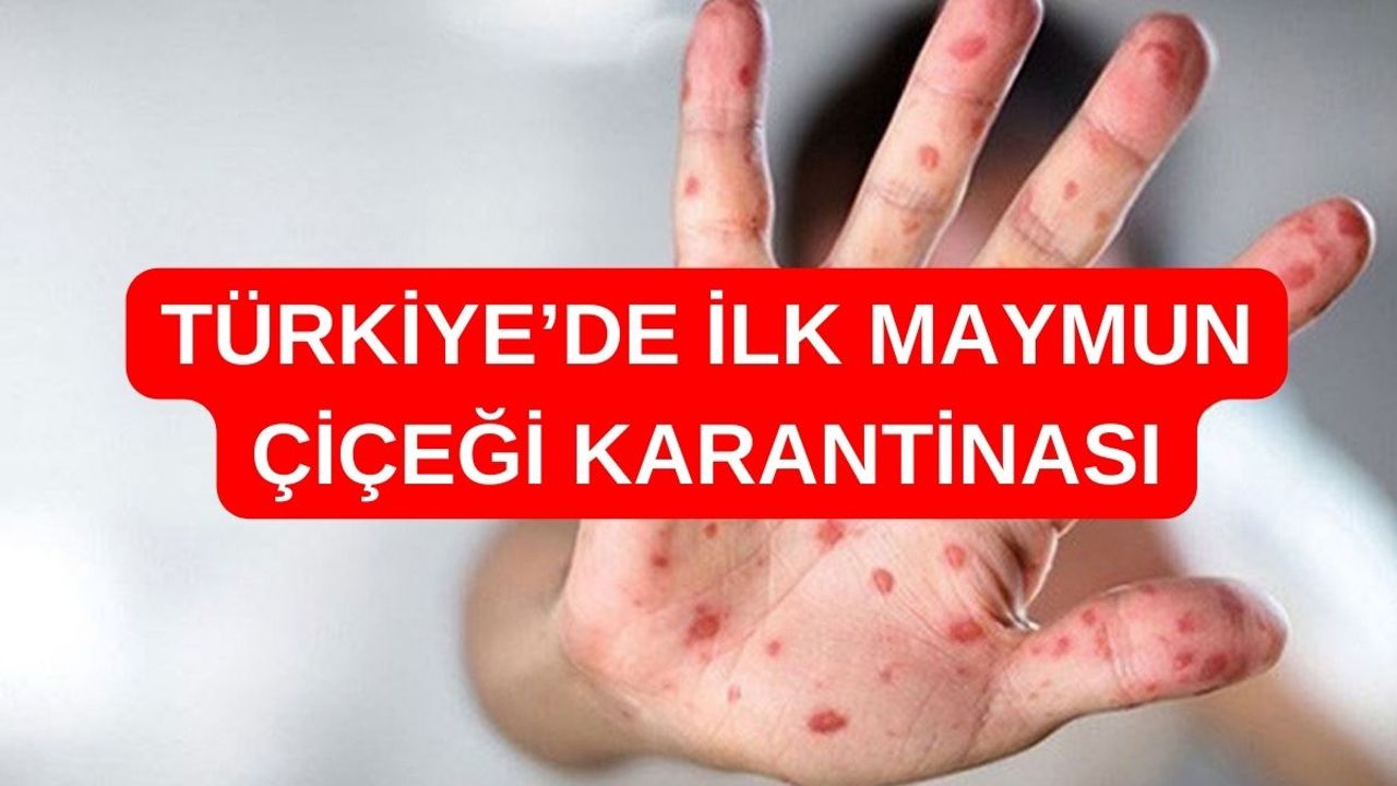 Korkutan Açıklama Geldi! Maymun Çiçeği Türkiye'ye Sıçradı!