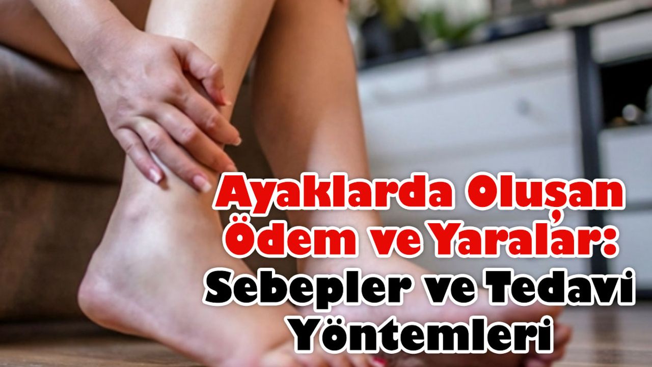 Ayaklarda Oluşan Ödem ve Yaralar: Sebepler ve Tedavi Yöntemleri
