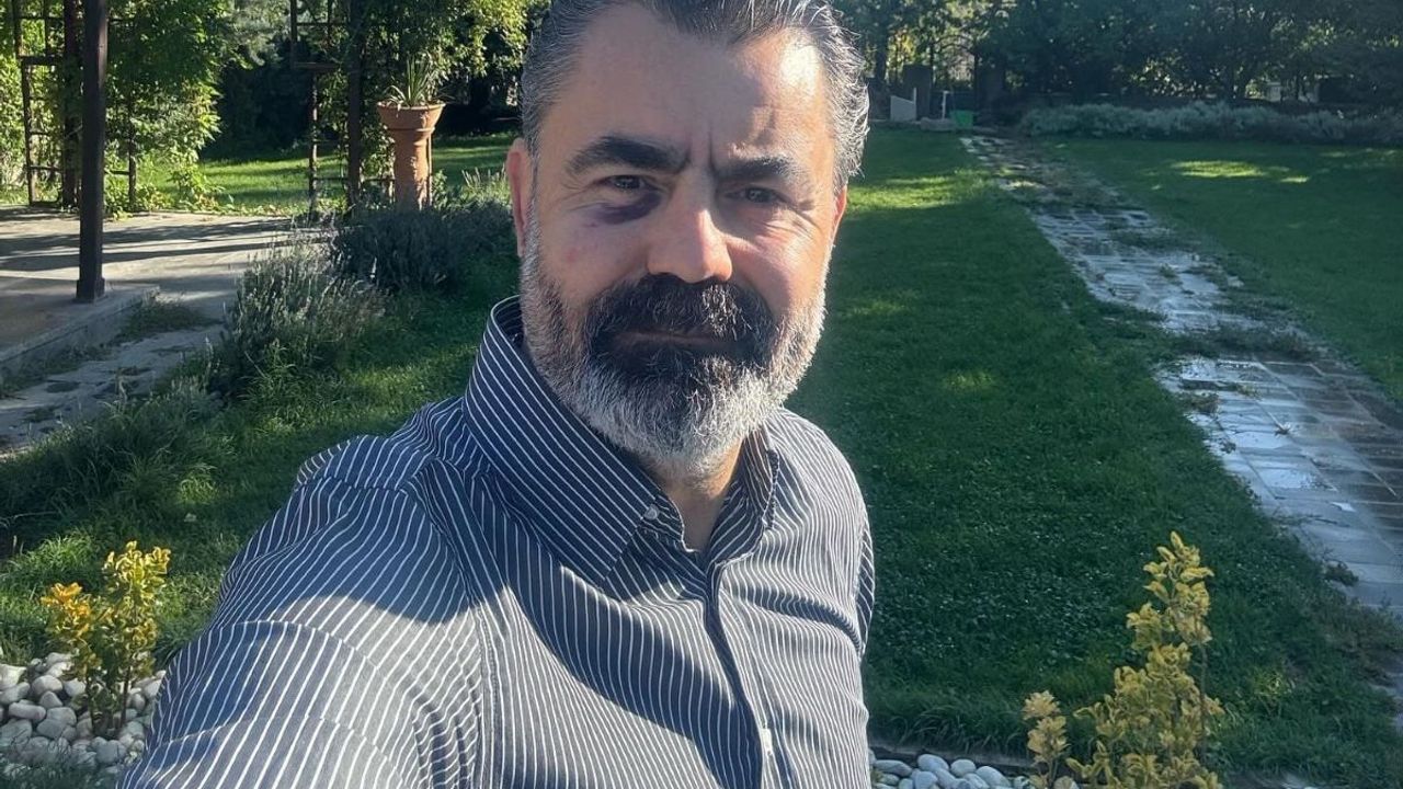 CHP’li Emre Ayan, Kayseri’de Saldırıya Uğradı: Arkamdan Sinsice…