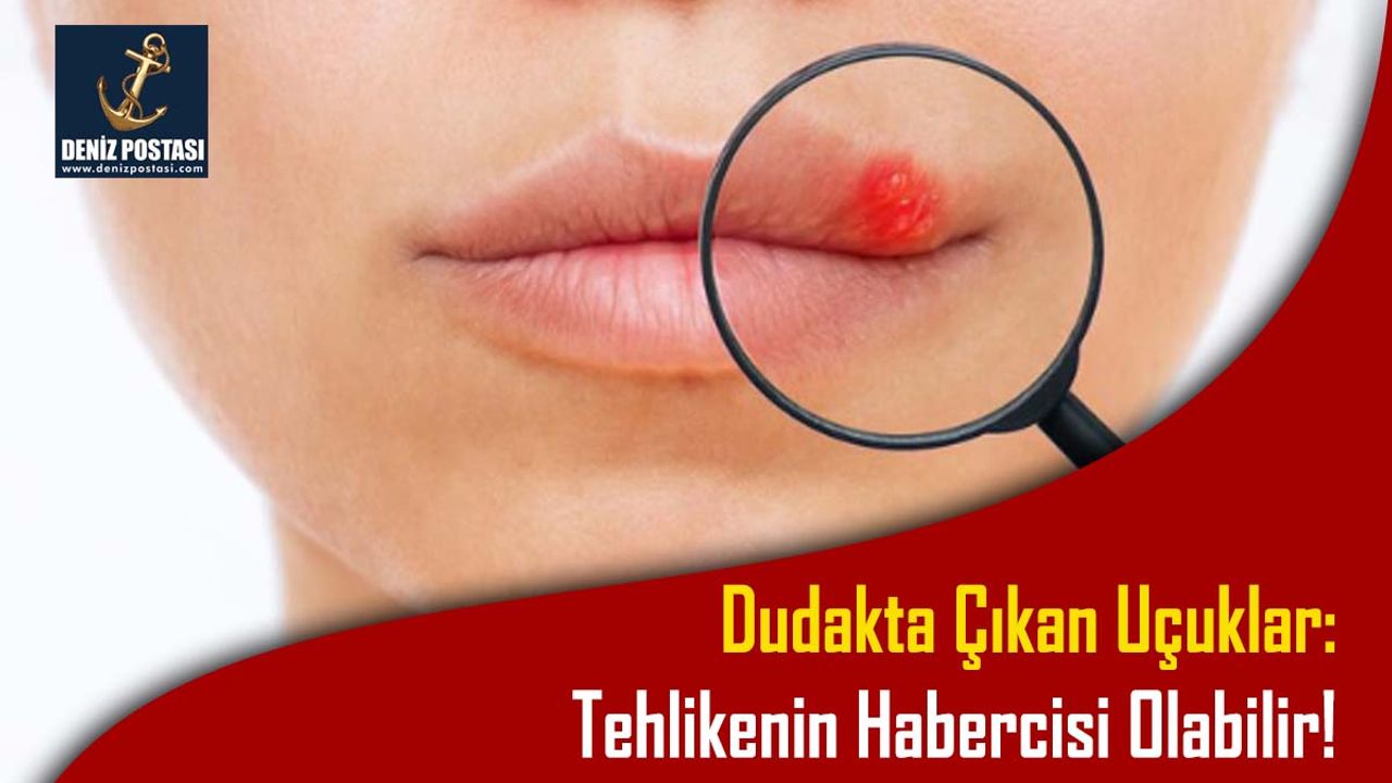 Dudakta Çıkan Uçuklar: Tehlikenin Habercisi Olabilir!