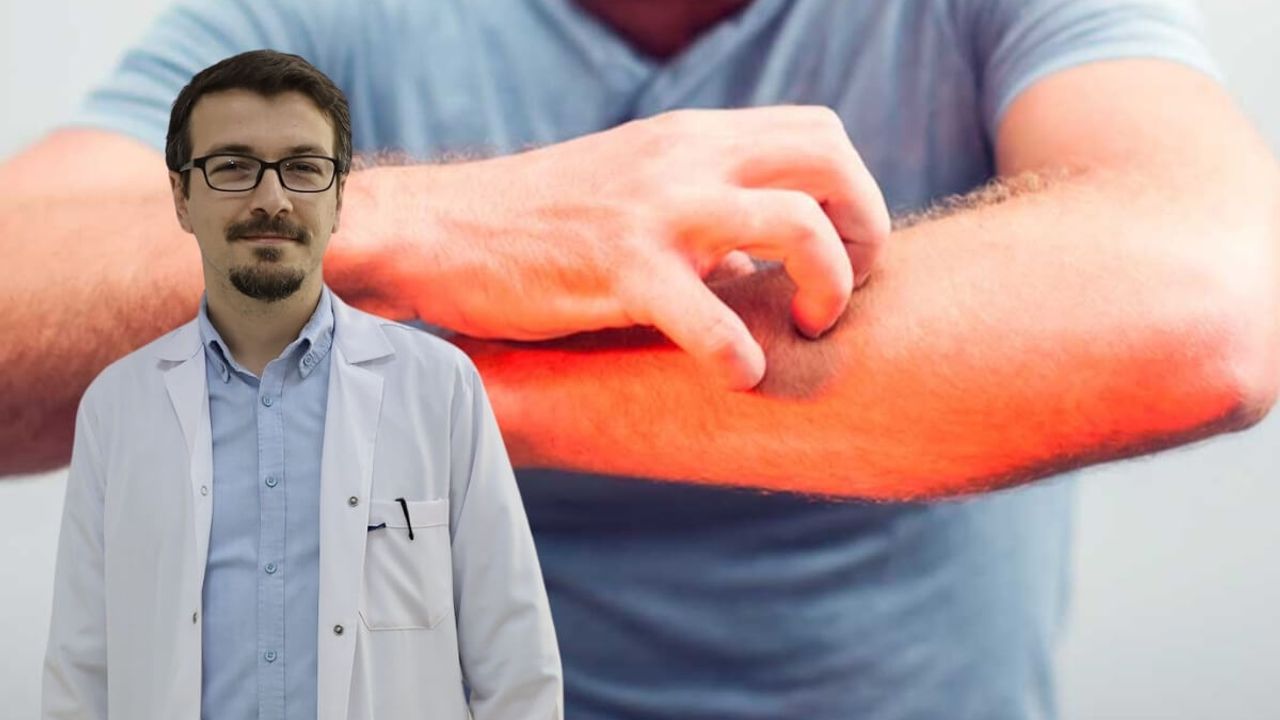 Durmadan Kaşınanlar Dikkat! Uzmanının Önemli Açıklama