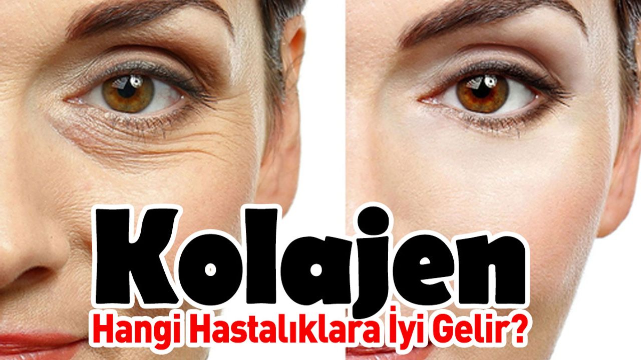 Kolajen Hangi Hastalıklara İyi Gelir?