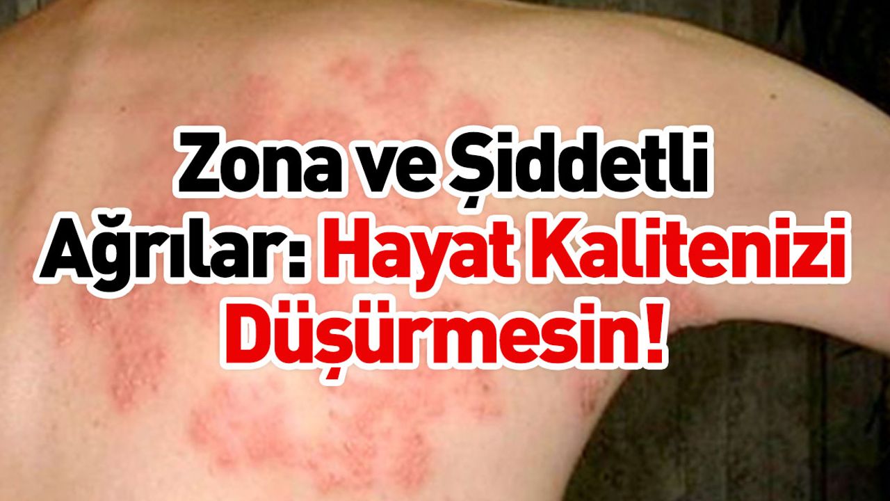 Zona ve Şiddetli Ağrılar: Hayat Kalitenizi Düşürmesin!