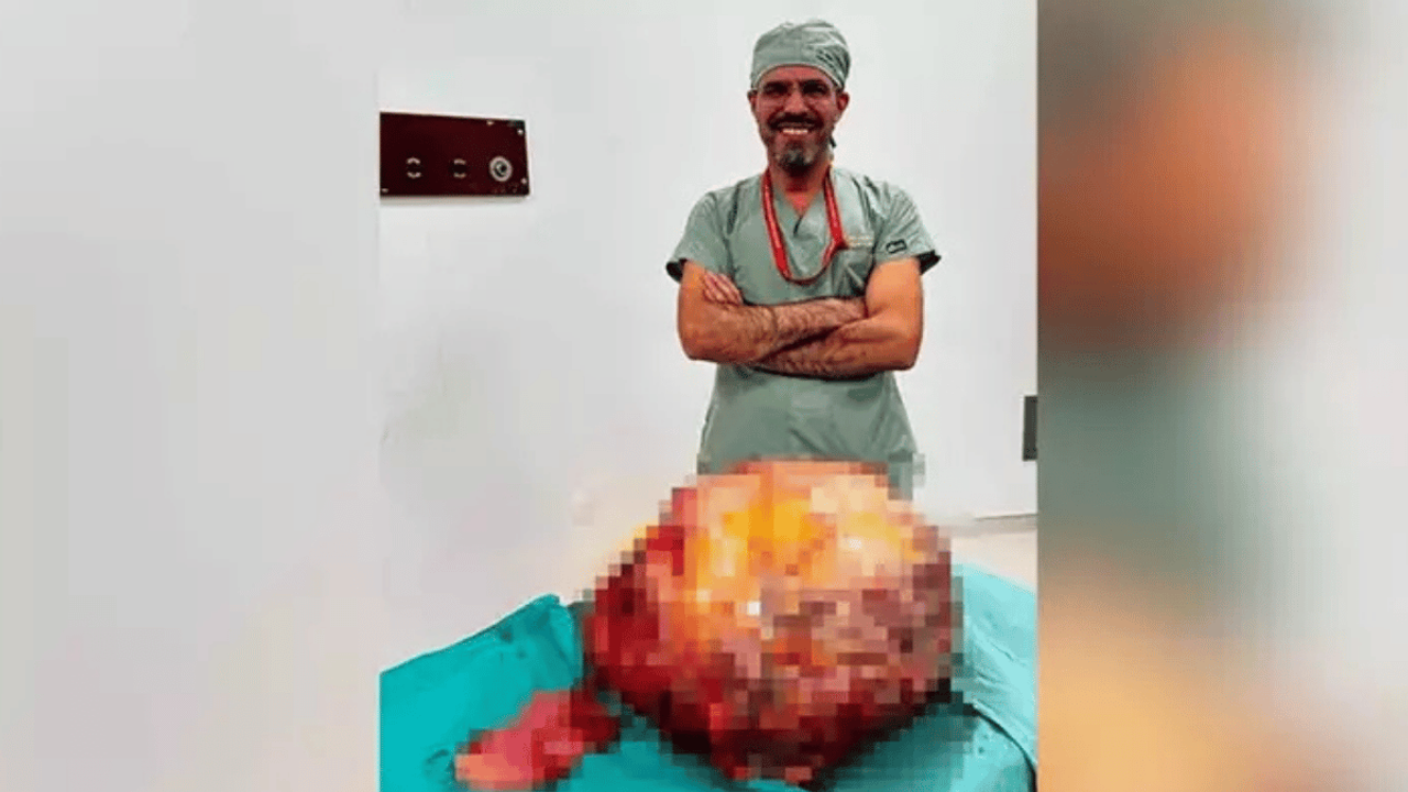 Karnından 26 kilo tümör çıktı! Karın ağrısı için gitmişti...