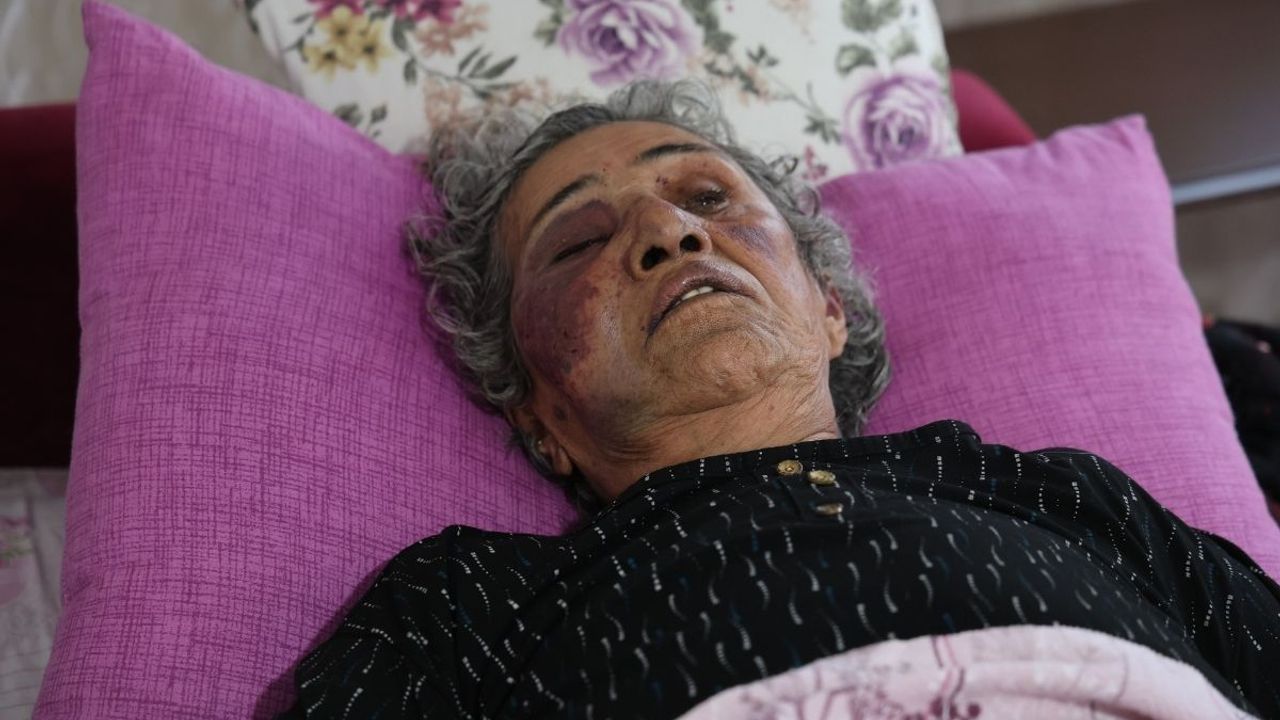 Yaşlı Kadının Başına Gelmeyen Kalmadı!  Yüzüğü İçin Öldüresiye Dövüldü!