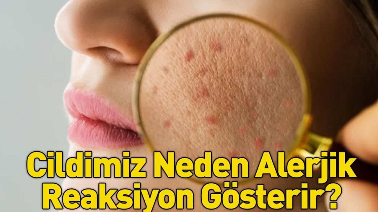 Cildimiz Neden Alerjik Reaksiyon Gösterir?
