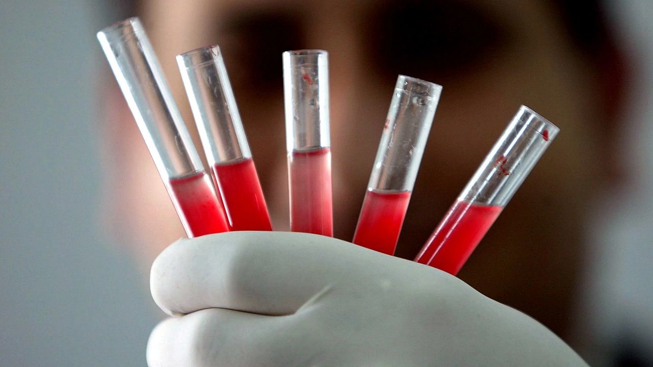 Hangi kan grubu daha şanslı! Daha az kanser oldukları açıklandı