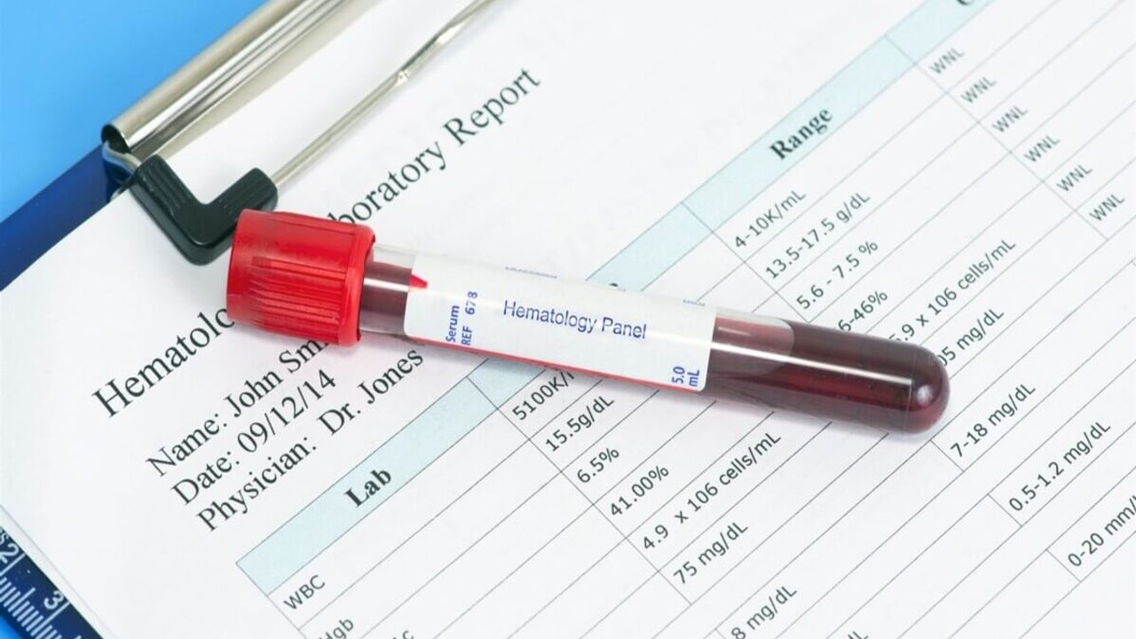 Kan Tahlillerinde Hangi Değerler Önemli? Doktorlar Uyarıyor