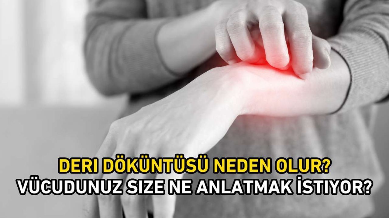 Deri Döküntüsü Neden Olur? Vücudunuz Size Ne Anlatmak İstiyor?