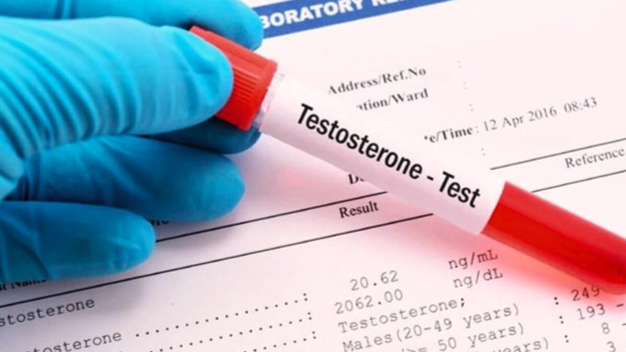 Erkeklerde Testosteron Eksikliği: Belirtiler ve Tedavi Yöntemleri