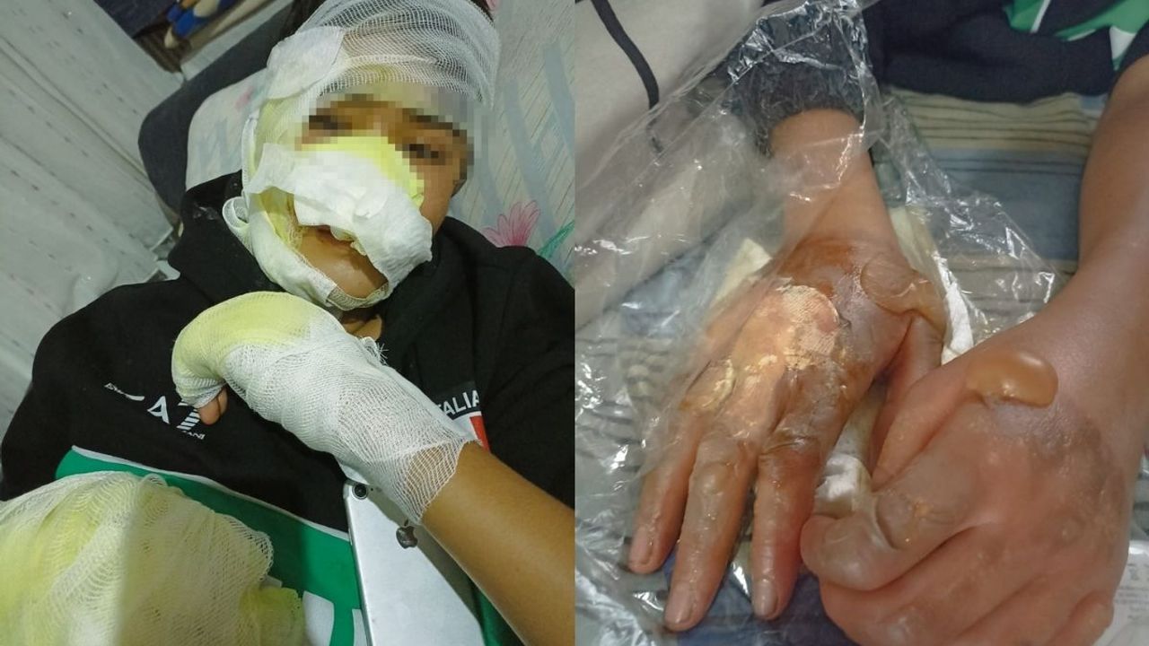 16 yaşındaki çocuğu önce fırına kilitlediler, sonra dereceyi yükselttiler!