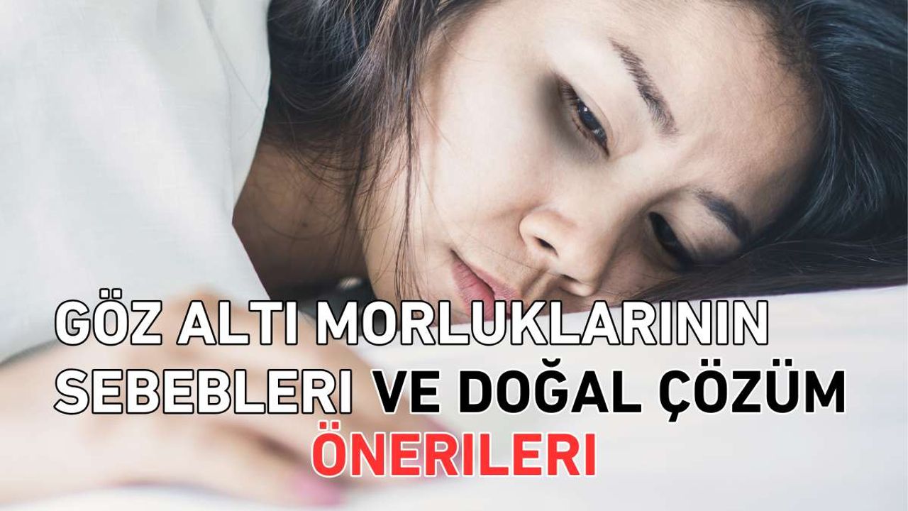 Göz Altı Morluklarının Sebepleri ve Doğal Çözüm Öneriler