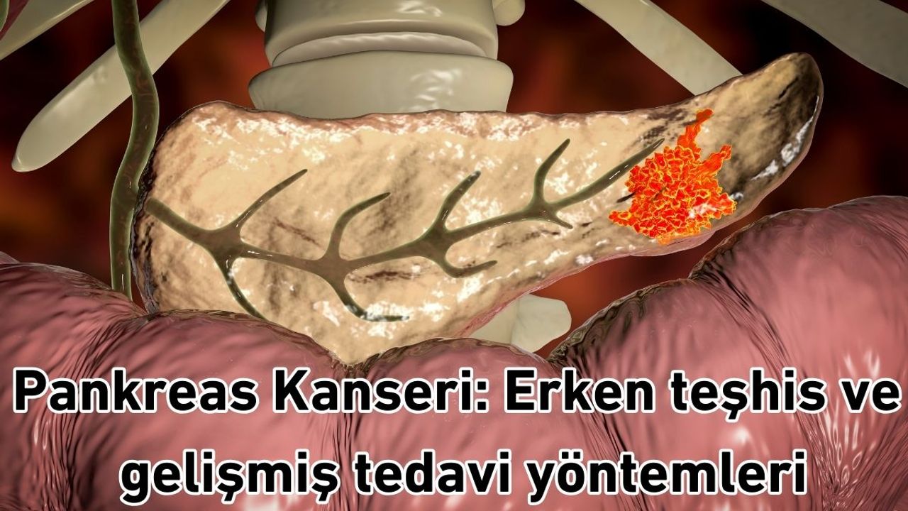 Pankreas Kanseri: Erken teşhis ve gelişmiş tedavi yöntemleri