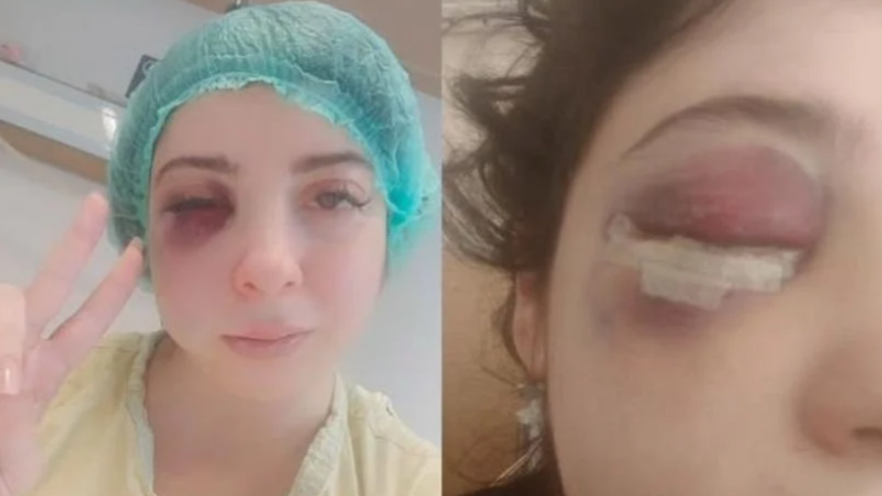 Korkunç olay! Kadın 3 ay sıvıyla beslenecek, bakın saldırgan ne diyerek dövdü
