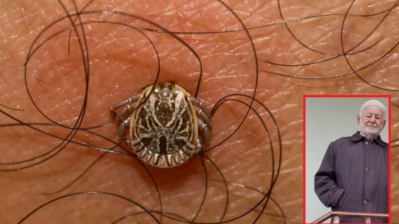 Koltuk altına yapışan kene 80 yaşındaki adamın sonu oldu! Ölü sayısı 5'e yükseldi