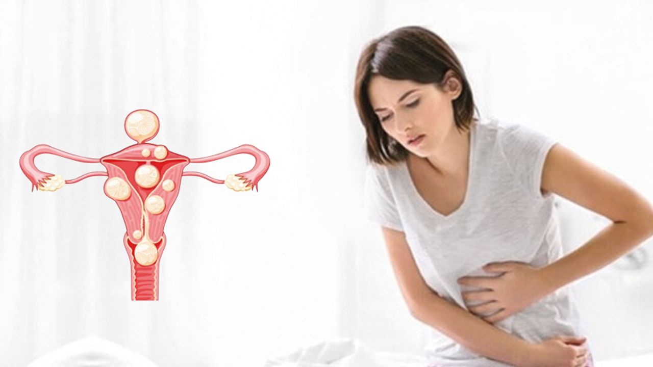 D Vitamini Eksikliği ve Miyomlar Arasındaki Bağlantı