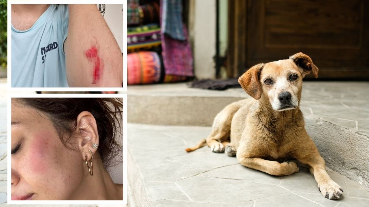 ‘Köpek beslediniz’ diyerek aileyi darp ettiler: 72 yaşında ki kadının kaburgaları kırıldı