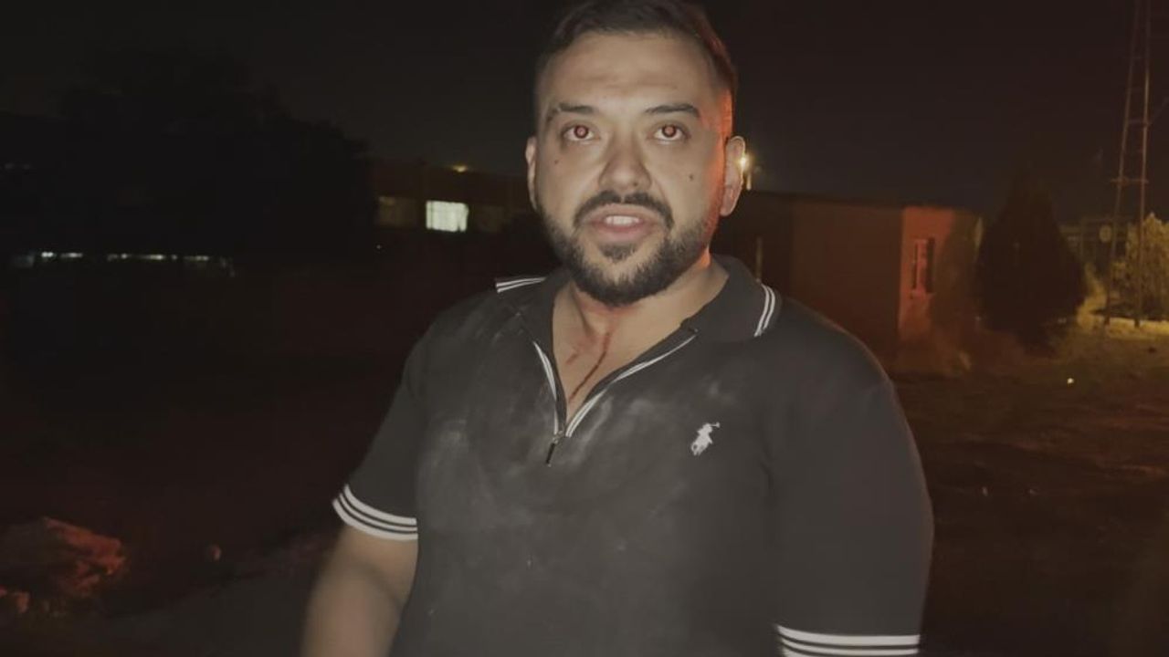 Kayseri'de aracını kurtarmaya çalışırken başına saçma isabet etti