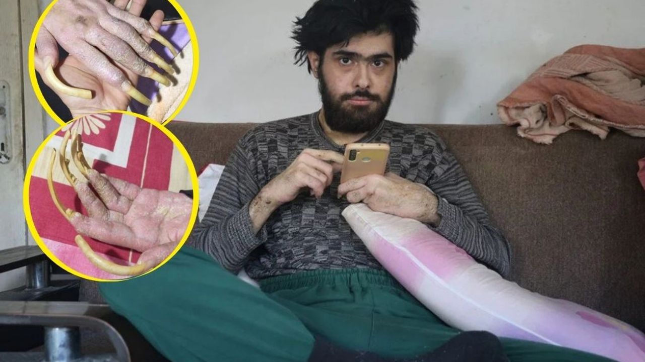 3 yıl sonra duş alıp, tıraş olan Barış'a teşhis kondu!