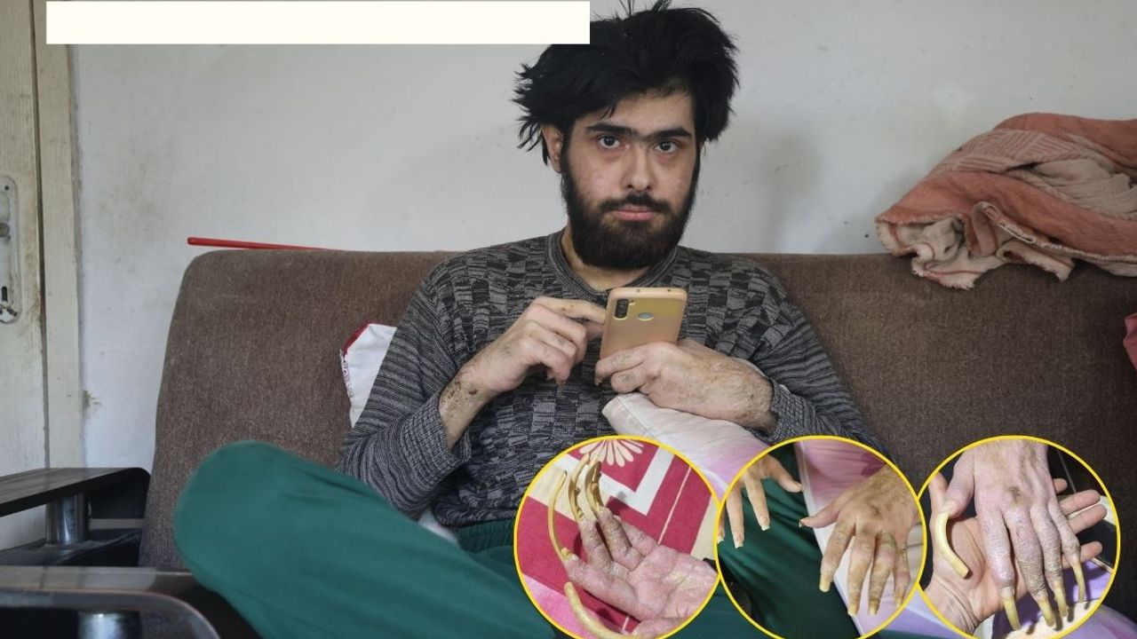 6 Şubat depremi genci mahvetti: “Mecbur olmasam yemek yemem”