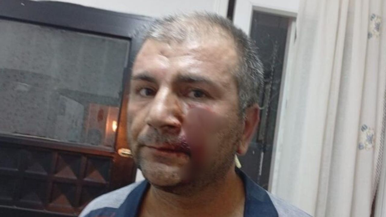 'Kenara çekilir misiniz' dedi, 10 kişiden dayak yedi!