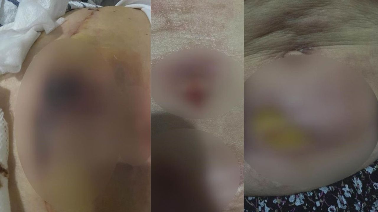 Kayseri'de özel hastanede ikinci skandal! Yağ aldırma ameliyatına giren sanatçının hayatı karardı!