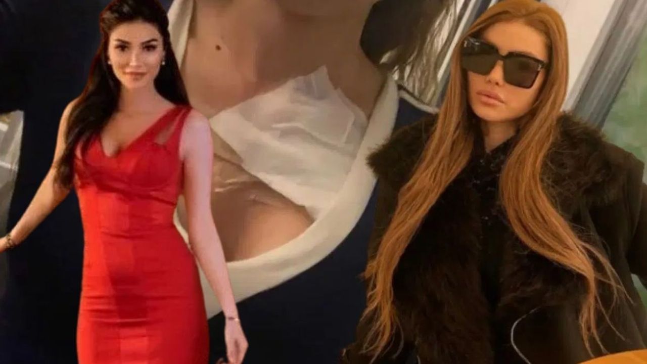 Gögüs estetiği olan sosyal medya fenomeninin hayatı karardı: Mezarlık yanımızda, çok kişi gömdük!