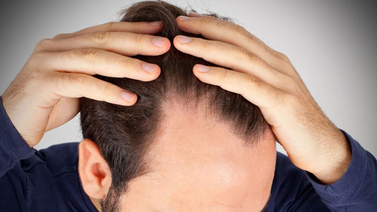 Saç dökülmesi yaşayanlar dikkat: Sebebi ve kurtulmanın yolu açıklandı