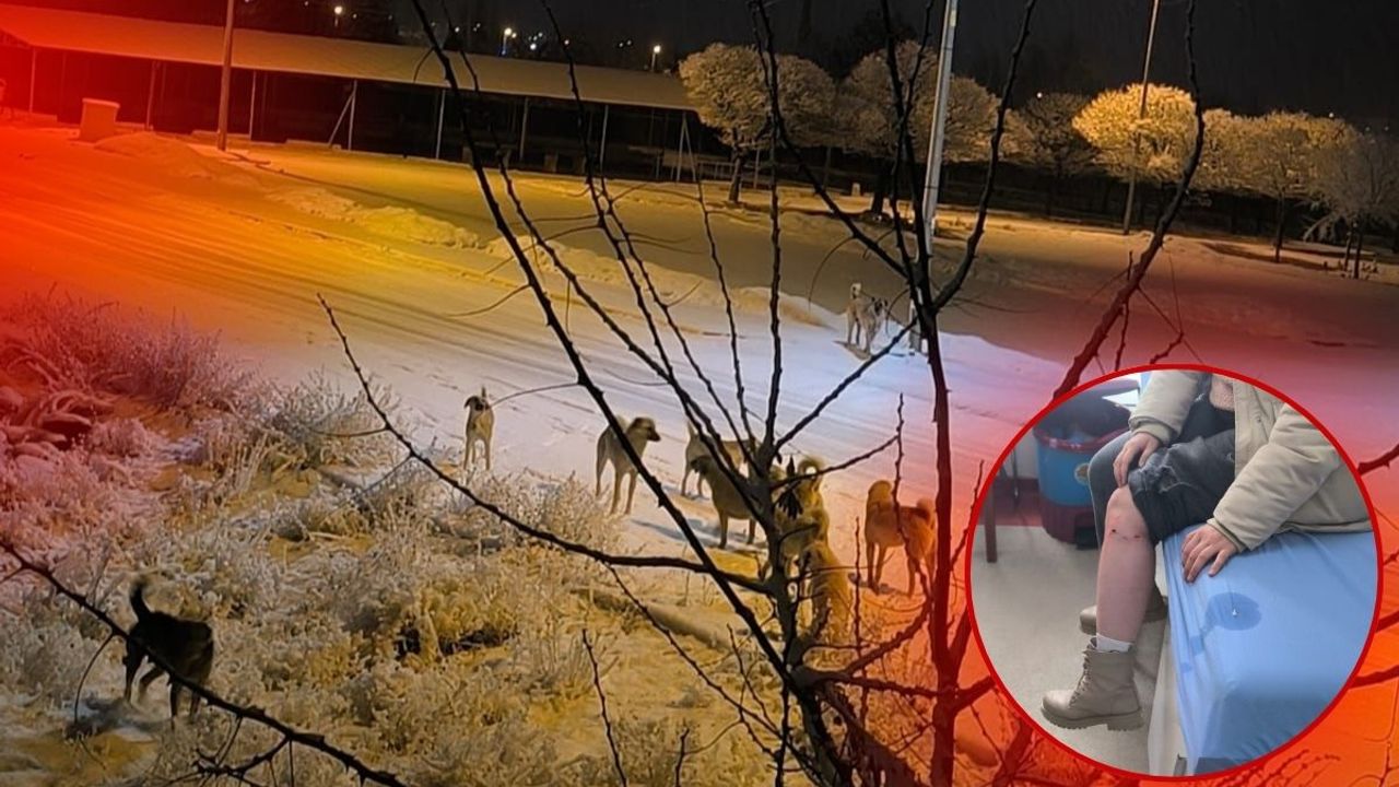 Kayseri'de Sokak Köpeği Saldırısı: Yaralanan kız hastaneye kaldırıldı