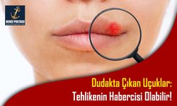 Dudakta Çıkan Uçuklar: Tehlikenin Habercisi Olabilir!