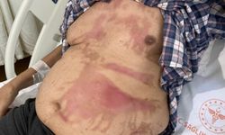 Mutfaklardaki gizli tehlike! Uzmanından uyarı geldi
