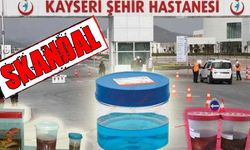 Sağlık Bakanlığı: Kayseri Şehir Hastanesinde Mağduriyet Yok