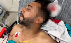 Yorgun merminin kurbanı oldu! Döner keserken başına saplandı