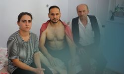 Kayseri'de karı kocanın korku dolu anları! Sahipli köpeğin saldırısına uğradılar