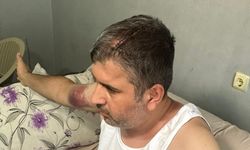 Miras anlaşmazlığı kanlı bitti: Dayı, yeğenini caddede beyzbol sopasıyla darbederek yaraladı