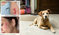 ‘Köpek beslediniz’ diyerek aileyi darp ettiler: 72 yaşında ki kadının kaburgaları kırıldı
