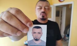 Saçlarını siyahlatmak için aldığı şampuan yüzünü tanınmaz hale getirdi!
