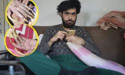 3 yıl sonra duş alıp, tıraş olan Barış'a teşhis kondu!