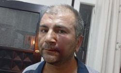 'Kenara çekilir misiniz' dedi, 10 kişiden dayak yedi!