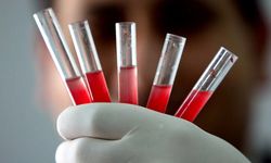 En yaygın kan grubu hangisi? Uzmanlar açıkladı