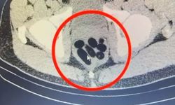 Kayseri’de uyuşturucu kuryesi kadının midesinden 500 gram metamfetamin çıktı